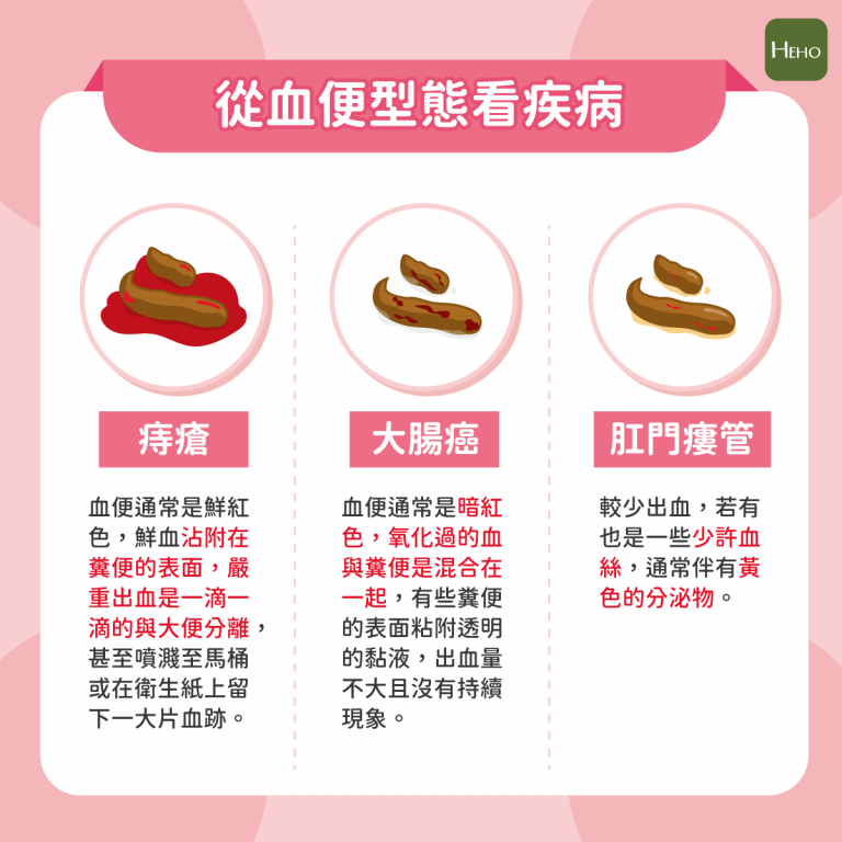 如何從血便看是什麼疾病？秒懂3種血便顏色差異！ - 豐榮醫院